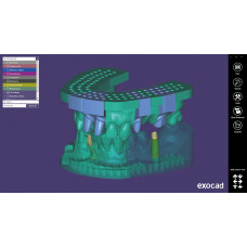 Exocad modulis Model Creator (3D spausdinimo modeliai)