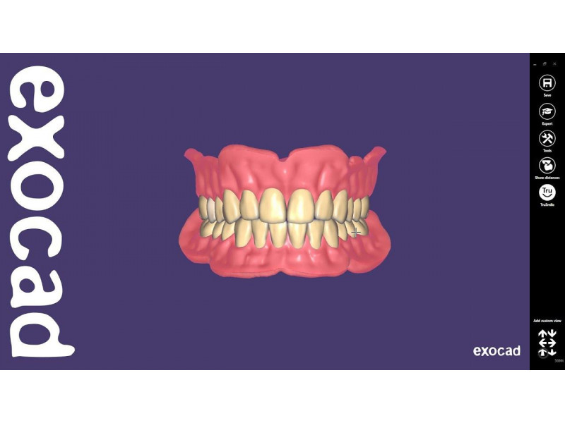 „Exocad“ pilnų dantų protezų modulis (pilni protezai)