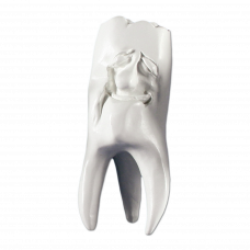 Hinrichs dantų kolekcija ''Manni'' gipsiniai dantys