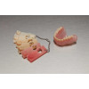 Formlabs resin Denture Base 1L - Derva protezų plokštelėms