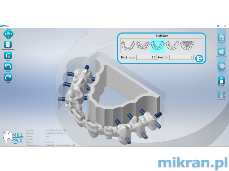 MILLBOX programinė įranga (versijos: Clinic, Eco, Standard, Expert).